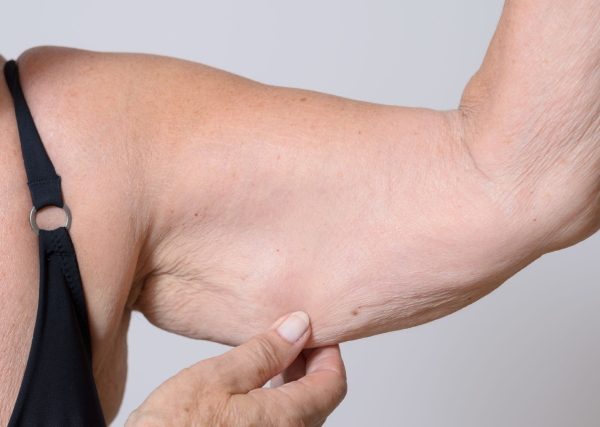 Why 99% of People Are Wrong About Saggy Arms: A Doctor Explains the Real Cause