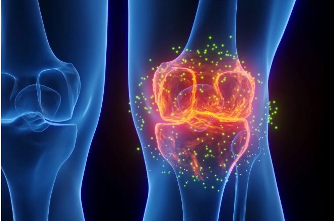 Goodbye, Knee Surgery? Scientists Regrow Lost Cartilage in Major Arthritis Breakthrough